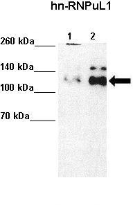 Валидация AssayVector ARM1840(2420)