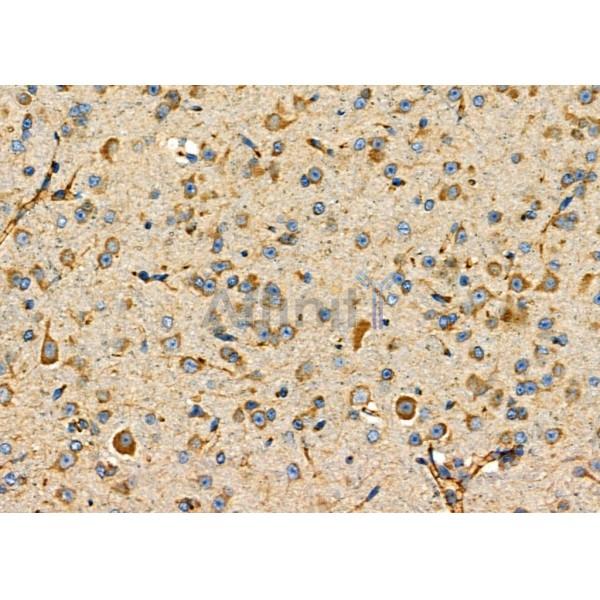 Валидация Affinity DF6956 - 18570