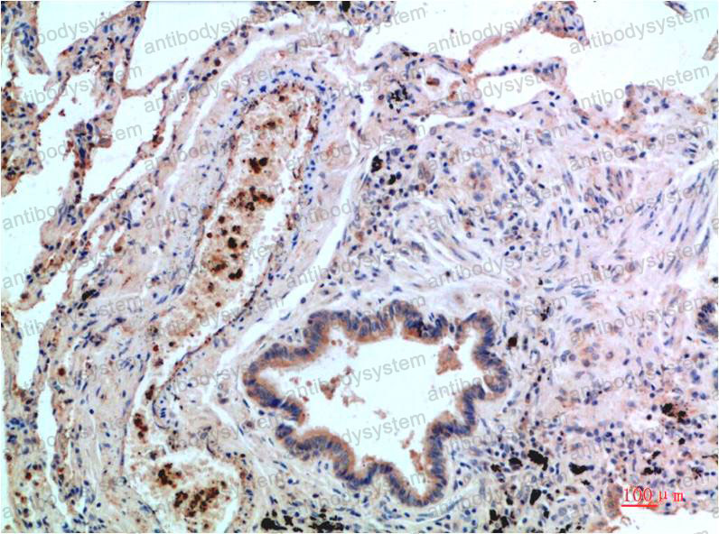 Валидация AntibodySystem RHH28306