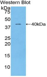 41295