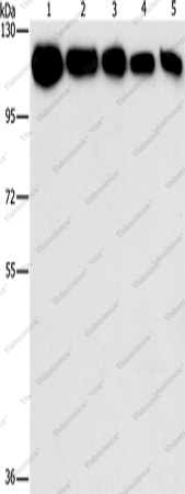 Вестерн-блоттинг, HK2, клетки A431, K562, 231, HeLa и HepG2