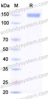 EHJ33902, SDS-PAGE