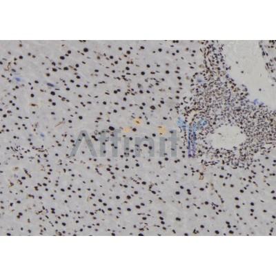 Валидация Affinity DF7888 - 19707