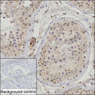 Валидация AntibodySystem RHK59901