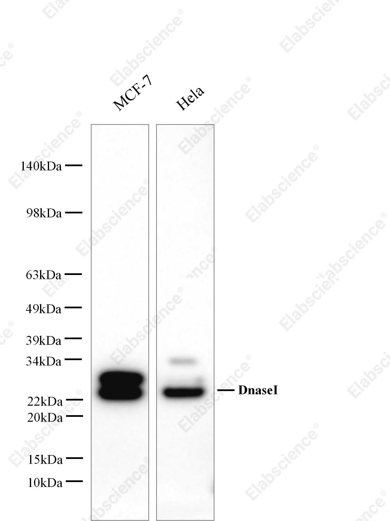 Вестерн-блоттинг, DnaseⅠ, клетки MCF-7 и HeLa