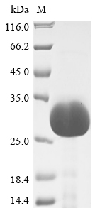 SDS-PAGE