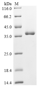 SDS-PAGE