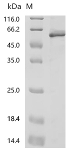 SDS-PAGE