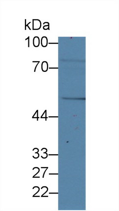 13974