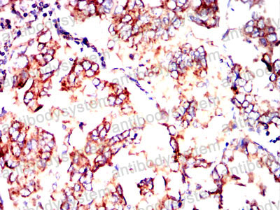 Валидация AntibodySystem RHC33503 (903)