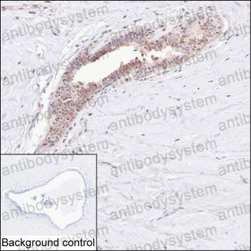 Валидация AntibodySystem RHP04902