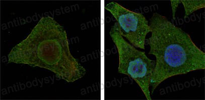 Валидация IF - AntibodySystem RHD08206