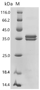 SDS-PAGE