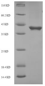 SDS-PAGE
