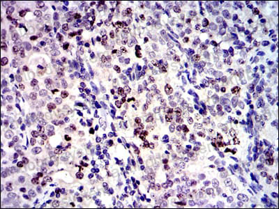 Валидация AntibodySystem RHA51404 (151)