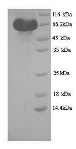 SDS-PAGE