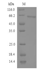 SDS-PAGE