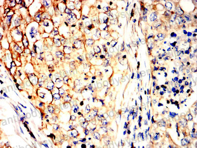 Валидация AntibodySystem RHC24106 (817)