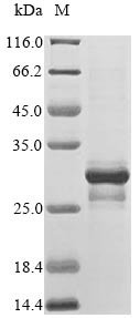 SDS-PAGE