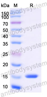 Валидация SDS-PAGE - AntibodySystem RWK25805