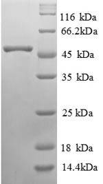 SDS-PAGE
