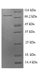 SDS-PAGE