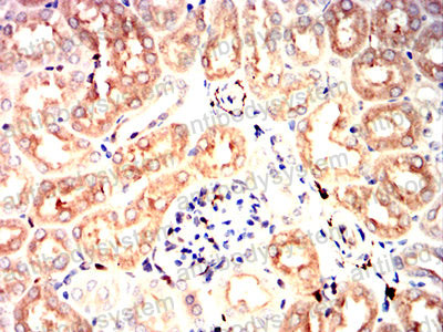 Валидация AntibodySystem RHC44503 (1042)