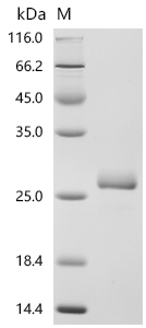 SDS-PAGE