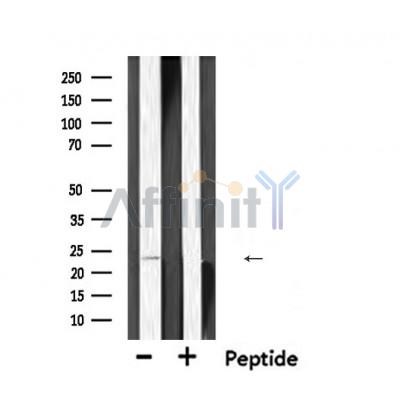 Валидация Affinity DF6110 - 17325