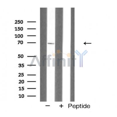 Валидация Affinity AF5274 - 2796