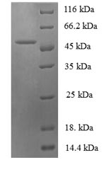 SDS-PAGE