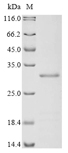 SDS-PAGE