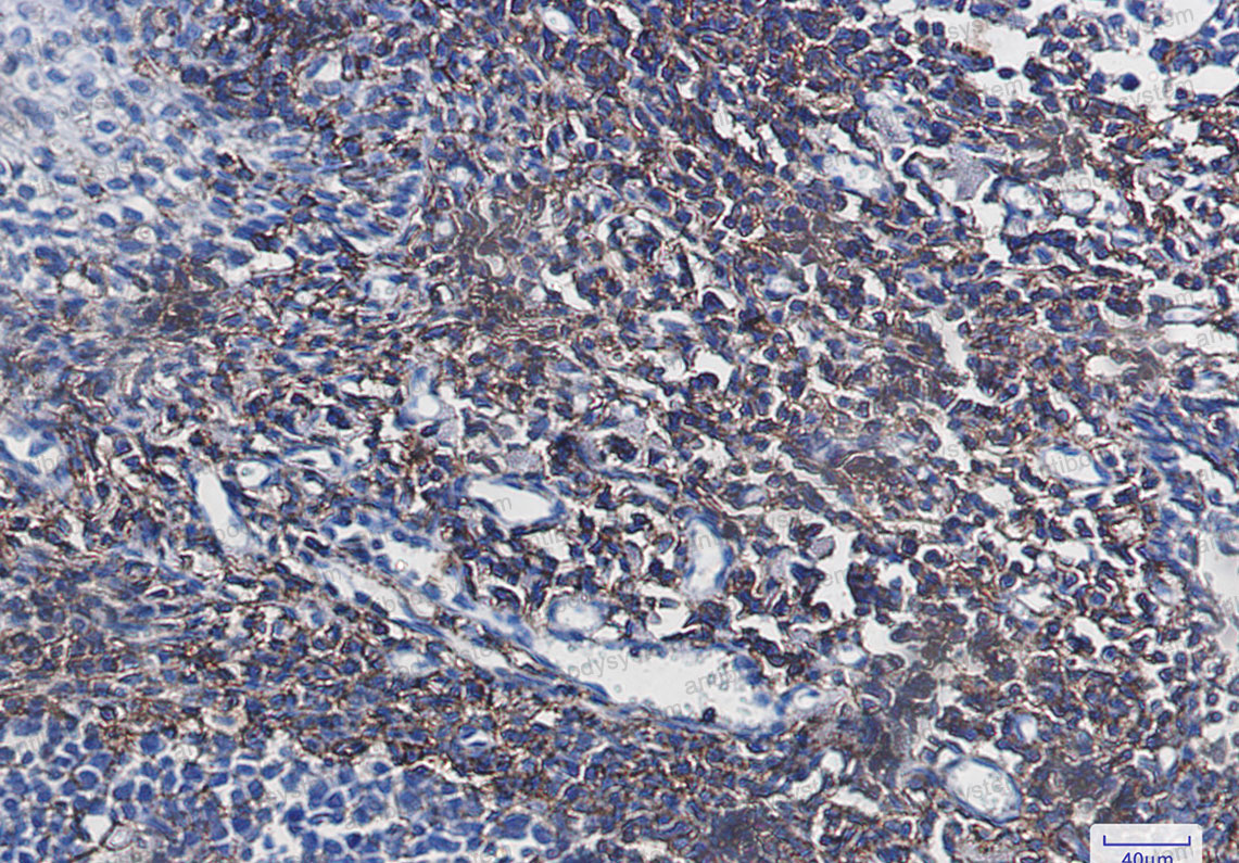 Валидация AntibodySystem RHD14801