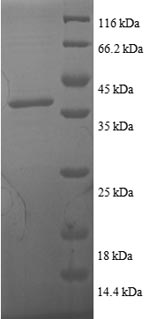 SDS-PAGE