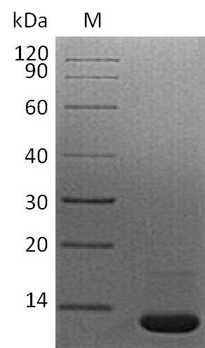 SDS-PAGE