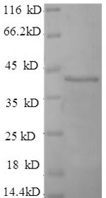 SDS-PAGE