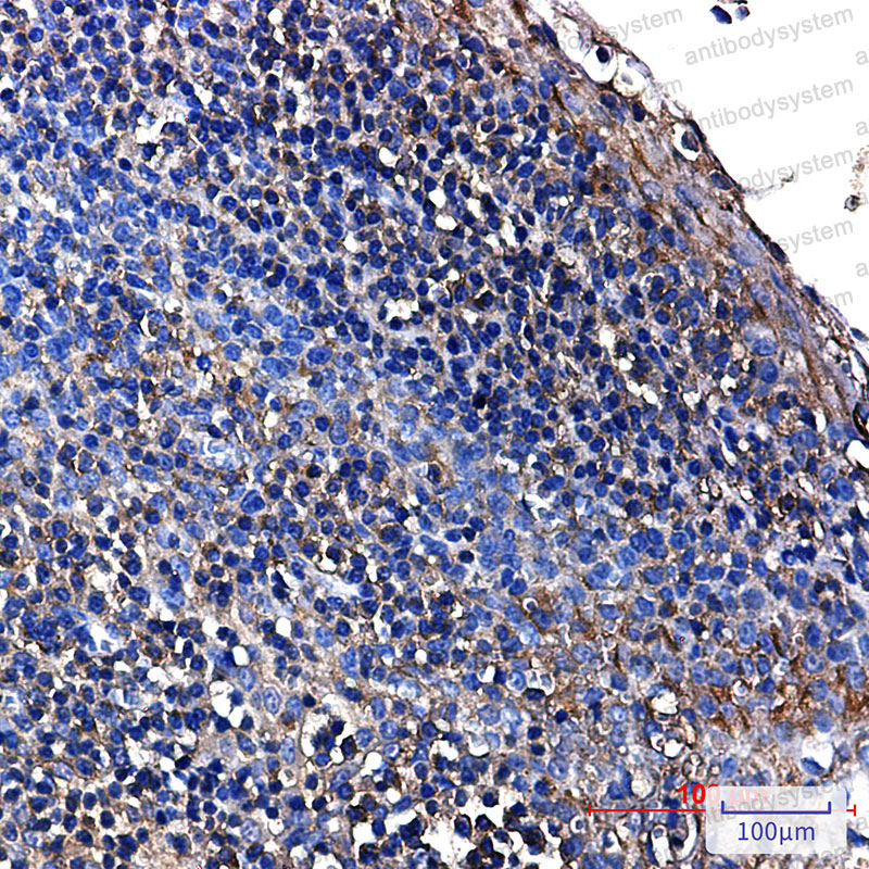 Валидация AntibodySystem RHC06001
