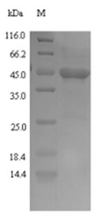 SDS-PAGE