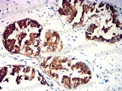 Валидация AntibodySystem RHD37701
