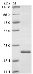 SDS-PAGE