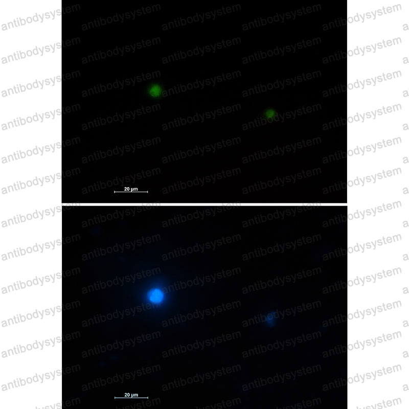 Валидация IF - AntibodySystem RHJ72101