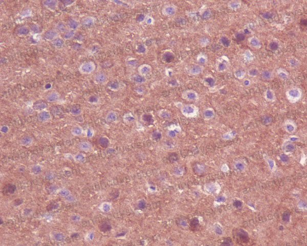Валидация AntibodySystem RHC09802 (616)