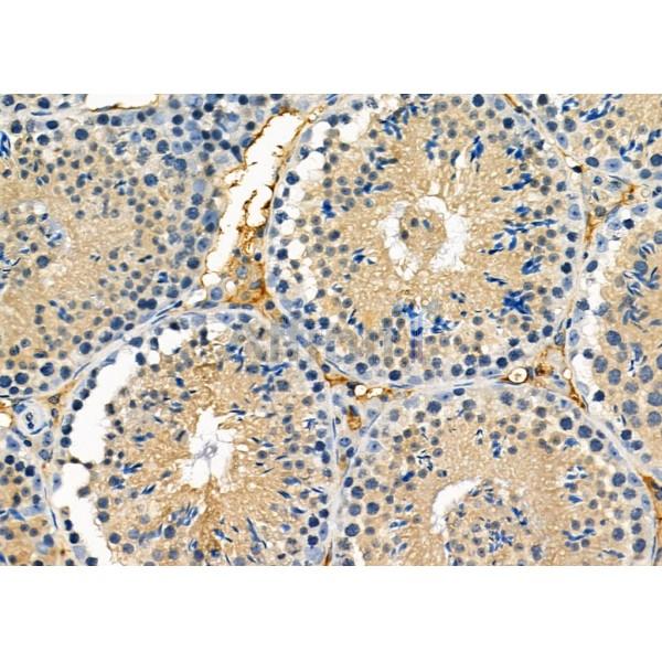 Валидация Affinity DF3600 - 14566