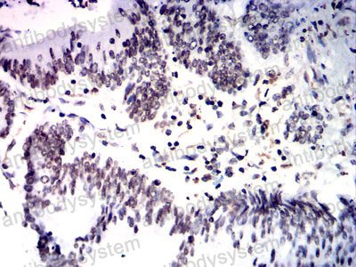 Валидация AntibodySystem RHE31502 (2073)