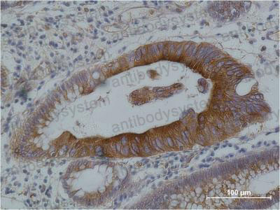 Валидация AntibodySystem RHF62207