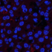 Иммунофлуоресценция, Phospho-JAK1 (Tyr1022), ткань печени мыши