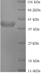 SDS-PAGE