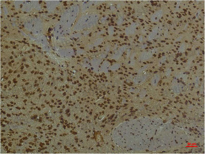 Валидация AntibodySystem RHD75805 (1810)