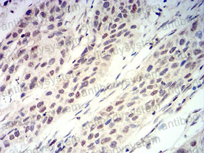 Валидация AntibodySystem RHG64302 (3043)