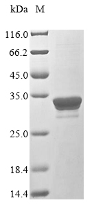 SDS-PAGE